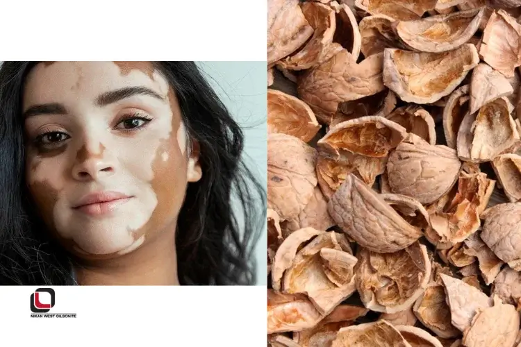 فواید پوست گردو برای پیسی